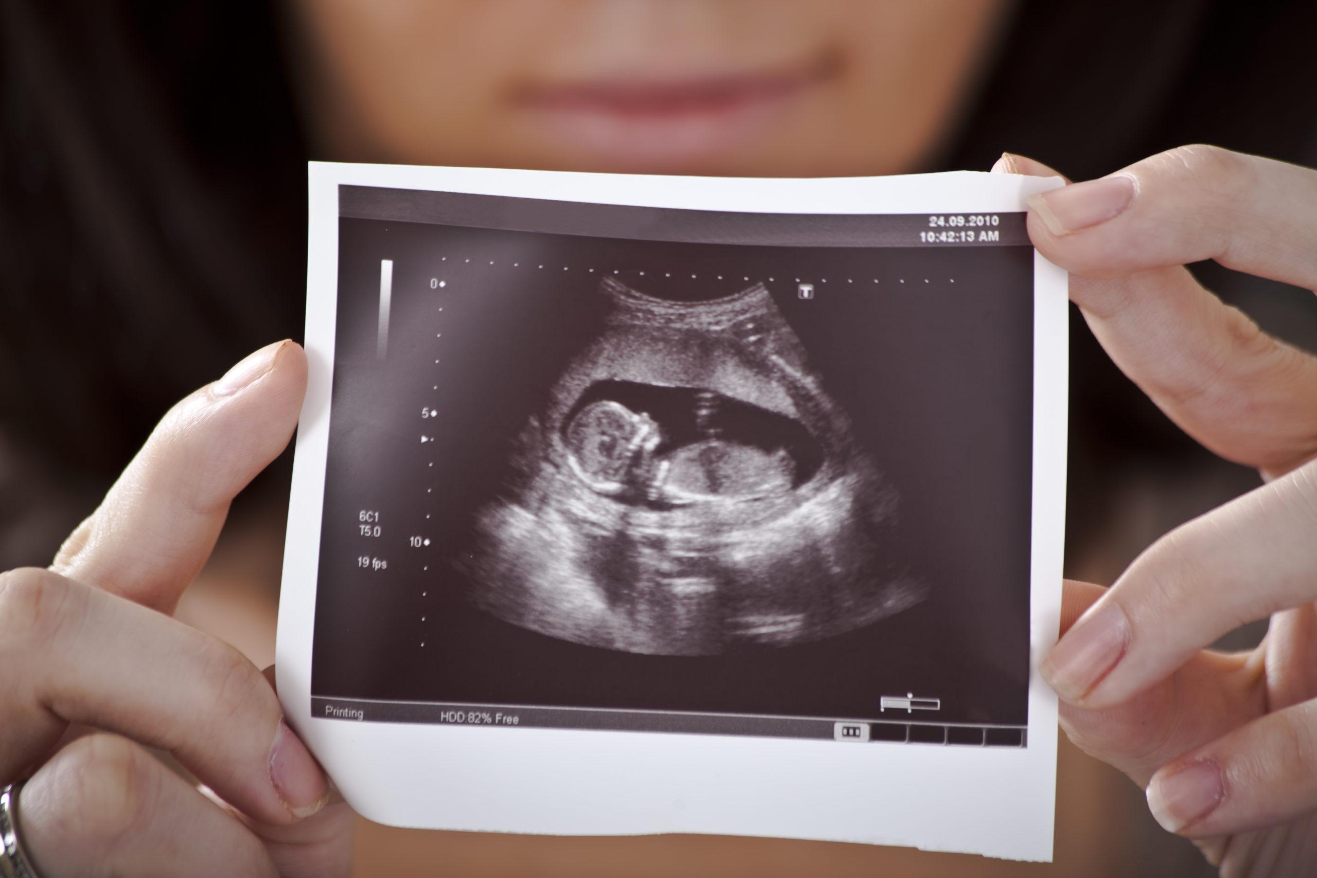 How to Know Baby is Healthy in Womb Without Ultrasound